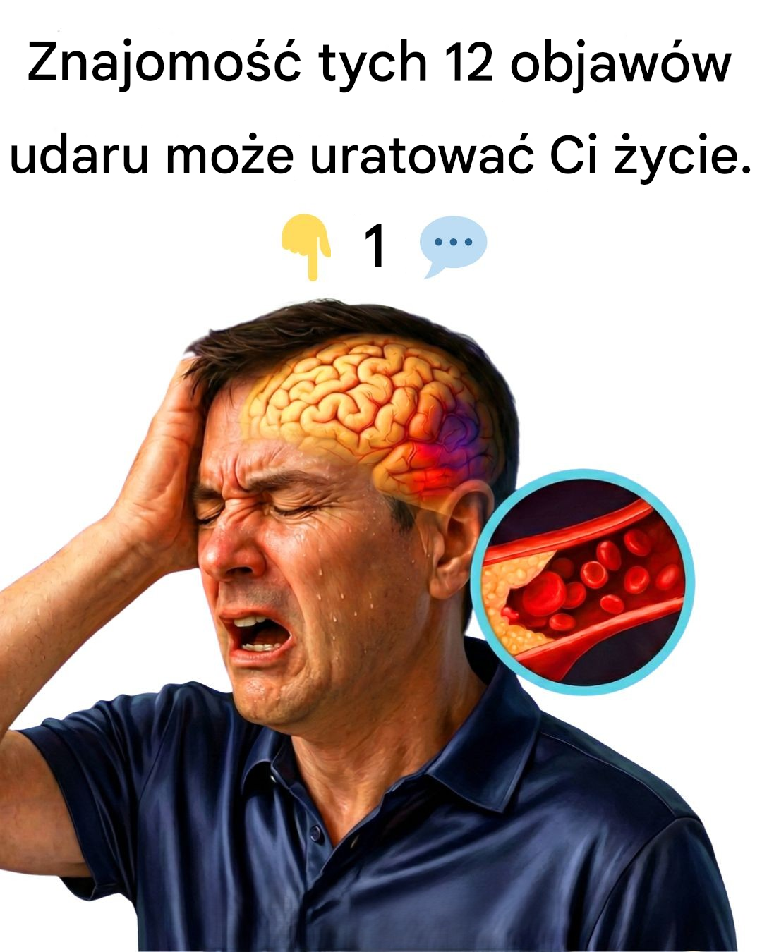 Znajomość tych 12 objawów udaru może uratować Ci życie