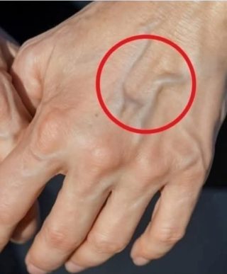 Naturalne sposoby na poprawę zdrowia żył i skóry