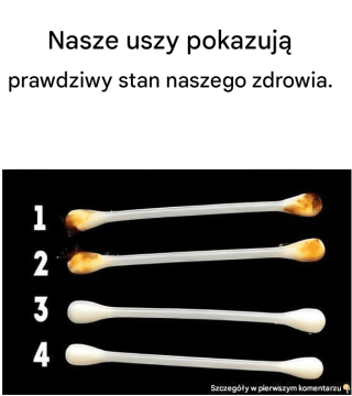 Nasze uszy pokazują prawdziwy stan naszego zdrowia.